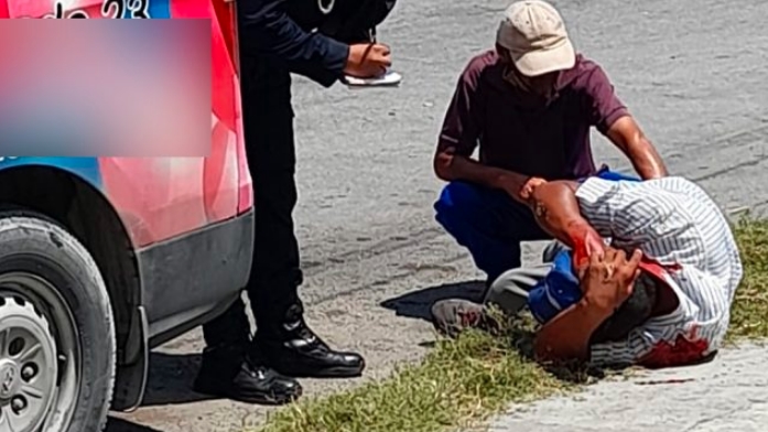 Le rajaron la cara y el cuerpo por ratero en el Mercado 23