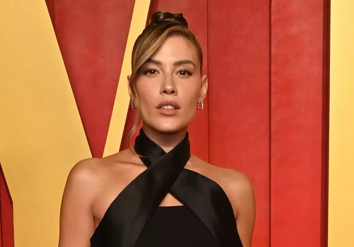 Michelle Salas revela enfermedad que desde hace algunos años padece en la piel
