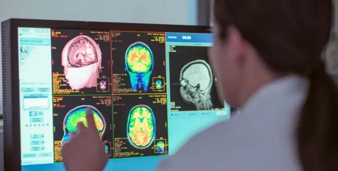 La adolescencia dura hasta los 32 años, según un nuevo estudio