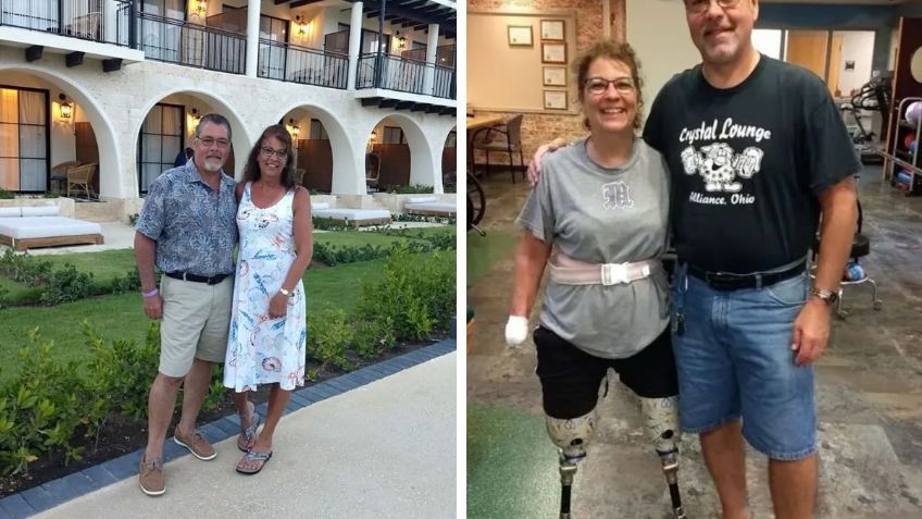 Mujer pierde brazos y piernas tras infección causada por su perro: “fue el peor día de mi vida”