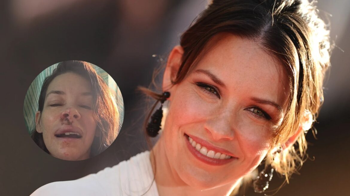 Evangeline Lilly revela daño cerebral tras sufrir un traumatismo craneoencefálico